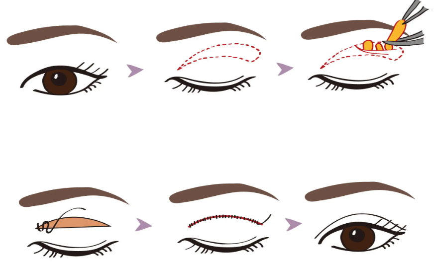 技術風格對比：自然風VS精致感
