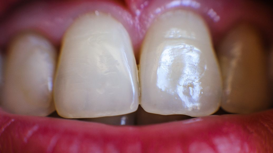 廣州牙科醫(yī)院收費(fèi)分析