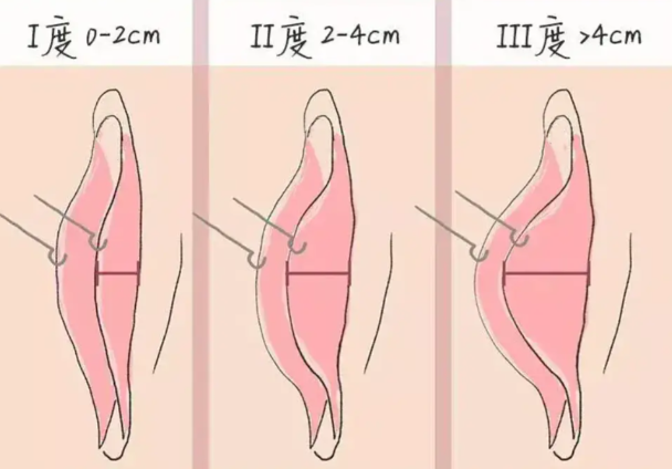 赤峰私密整形醫(yī)院哪家好