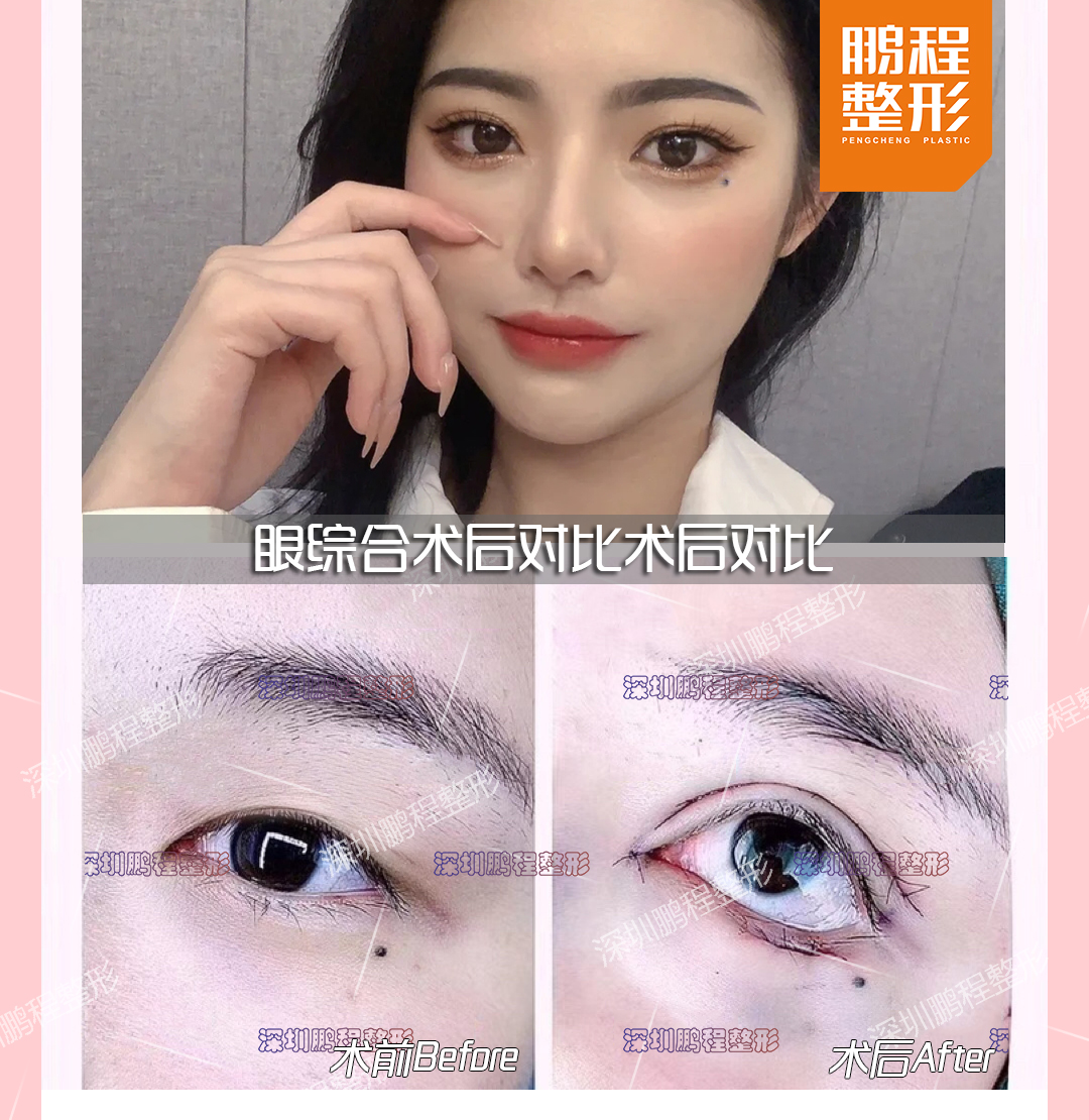 鄭州東方整形美容醫(yī)院:口碑評價特別不錯