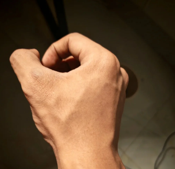 二、關(guān)于北京陰莖假體植入術(shù)私立醫(yī)院的收費情況www.sorencai.cn