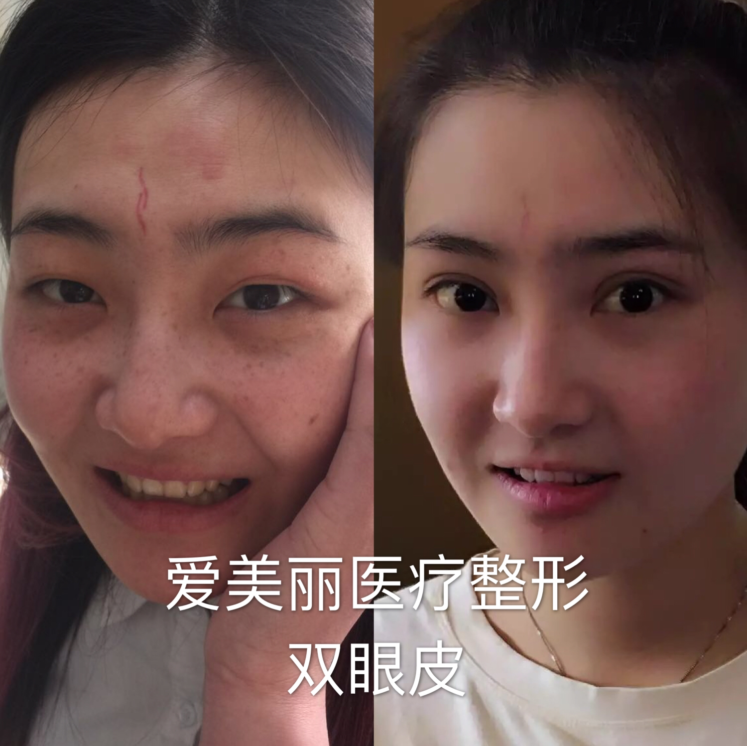 鄭州東方整形美容醫(yī)院：技術實力特點