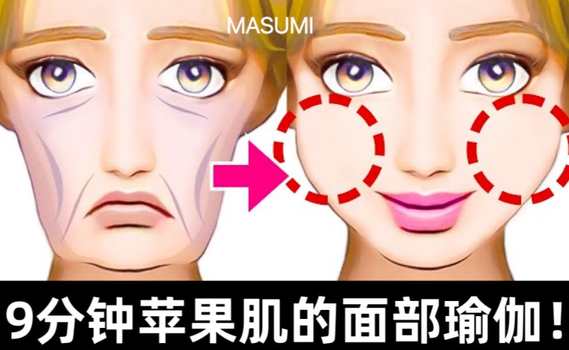 上海蘋果肌部位饅化修復(fù)術(shù)後護理要點