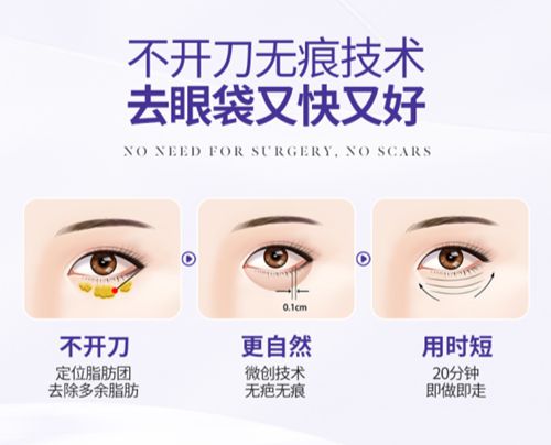 紫潔去眼袋是正規(guī)醫(yī)院?jiǎn)? width=