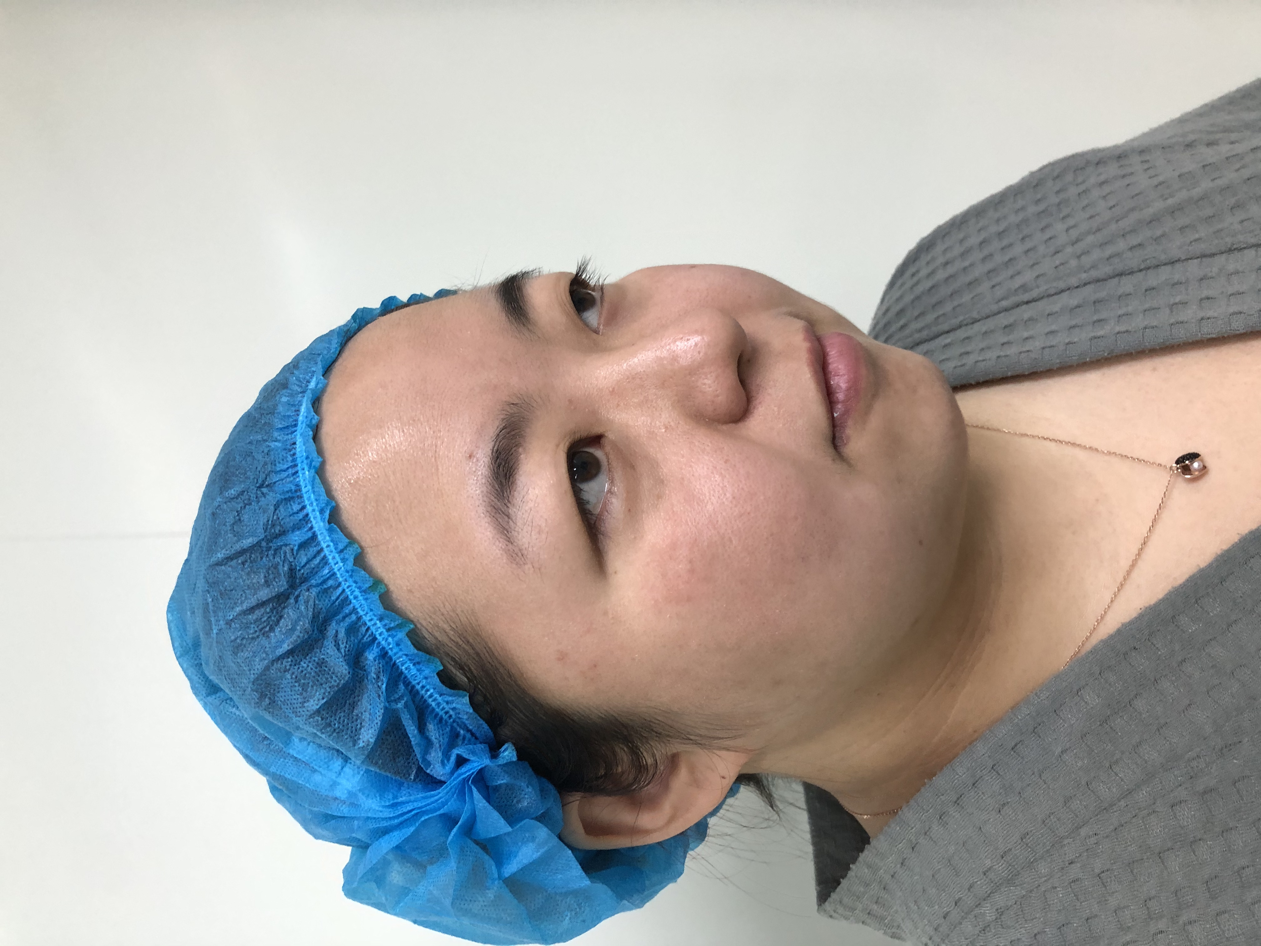 鄭州東方賀潔修復(fù)雙眼皮價(jià)格及項(xiàng)目情況？