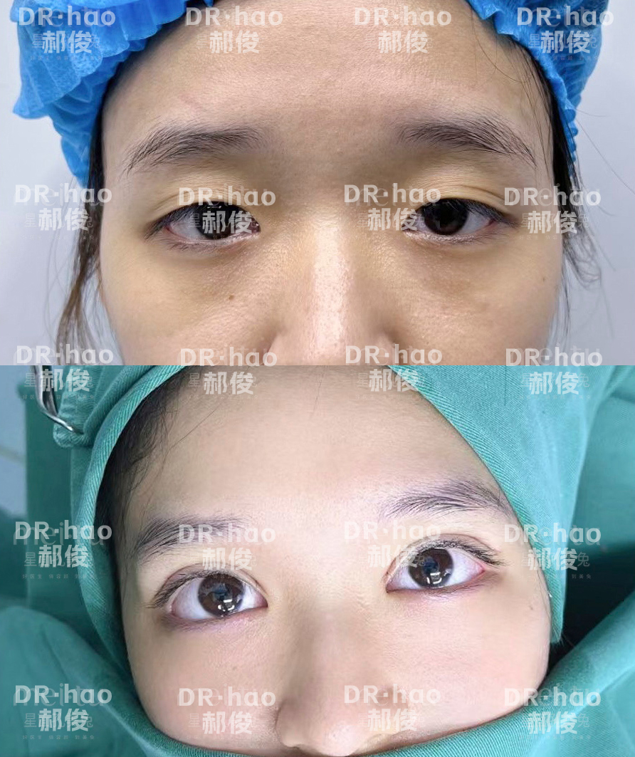 鄭州東方整形美容醫(yī)院情況如何？