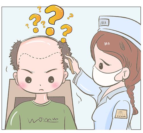 四、針對不同類型的M型發(fā)際線，有哪些治療建議？