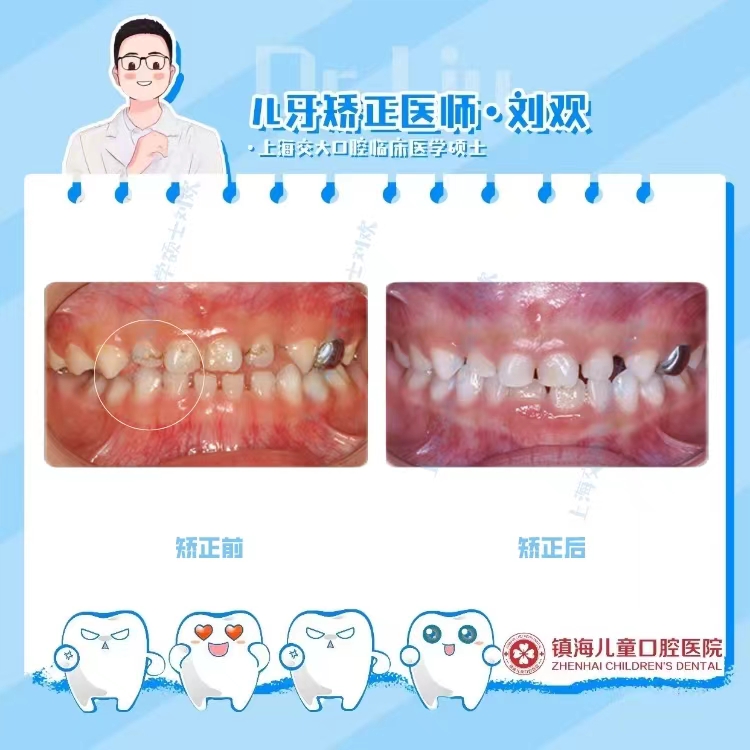 二、營口團圓口腔醫(yī)院是正規(guī)醫(yī)院嗎——技術篇