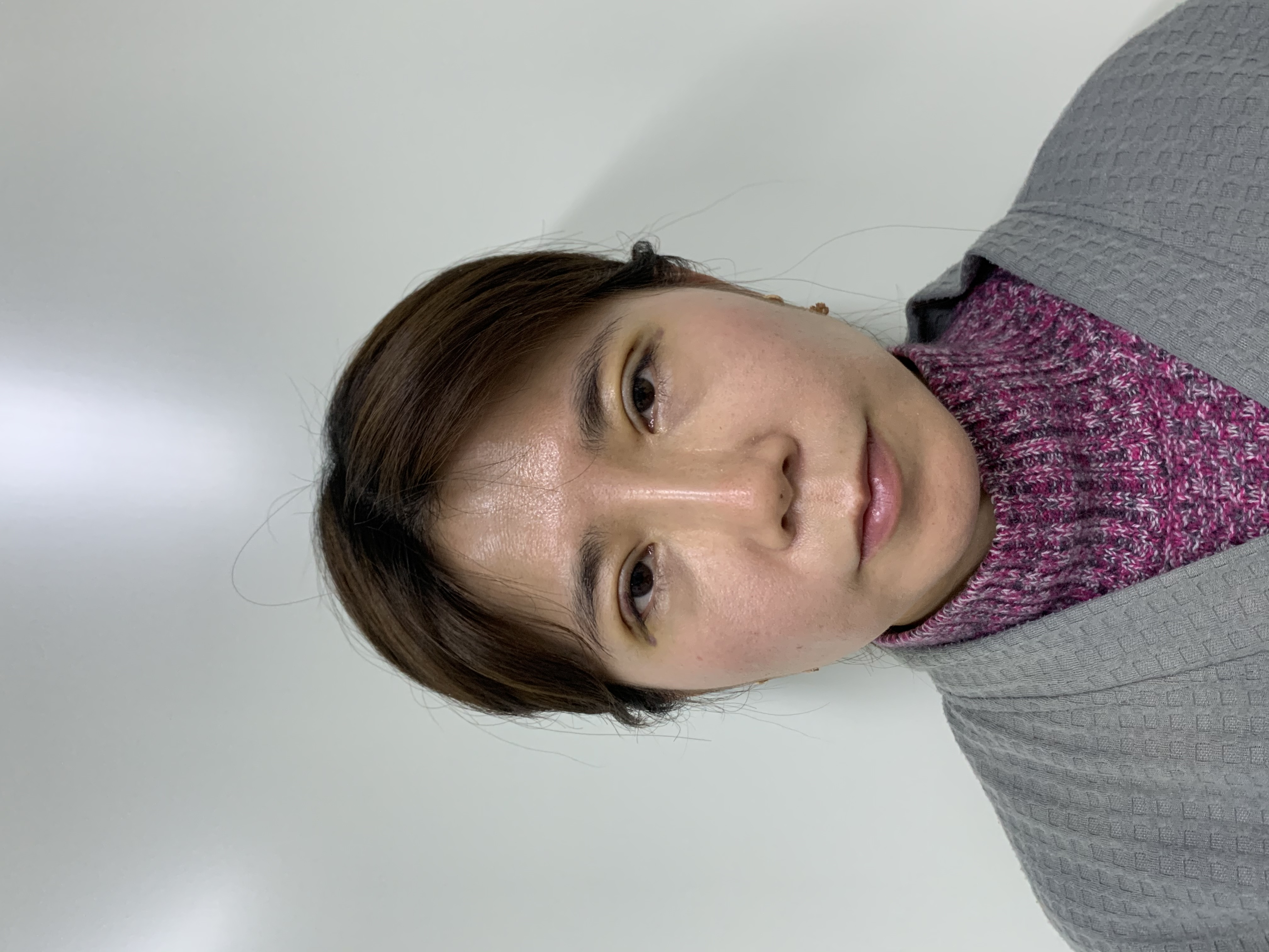 鄭州東方賀潔修復(fù)雙眼皮有啥獨(dú)特優(yōu)勢(shì)？