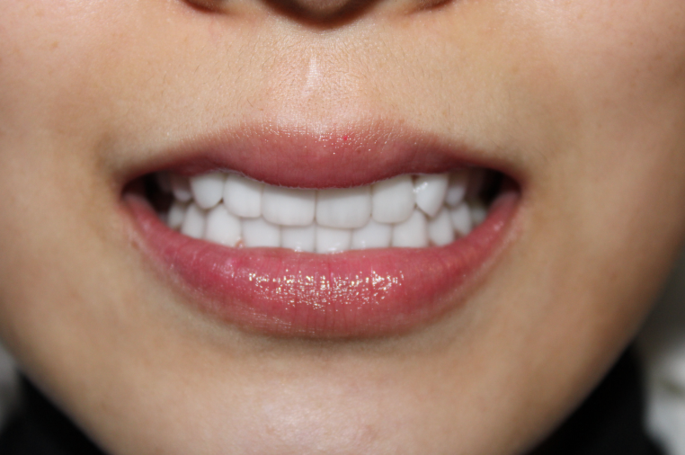 四、東莞國貿(mào)口腔醫(yī)院是國有的嗎——醫(yī)院價格情況