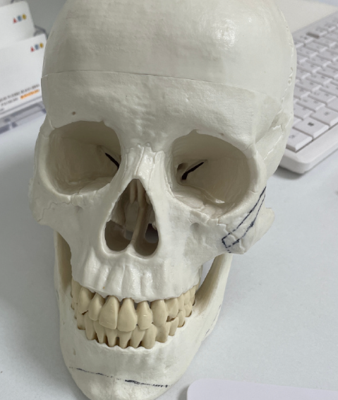 韓國(guó)345輪廓真實(shí)測(cè)評(píng)