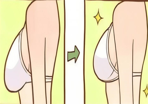 林沸騰隆胸和余力隆胸哪個(gè)更厲害，從技術(shù)、口碑、價(jià)格全方位為你解讀！