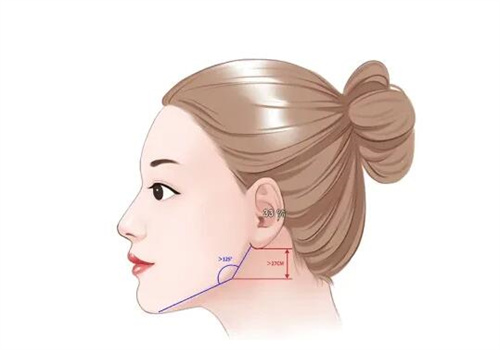 高俊銘和景熙翔哪個(gè)磨骨技術(shù)更好？技術(shù)亮點(diǎn)、手術(shù)風(fēng)格、真實(shí)案例、口碑評價(jià)來看下！