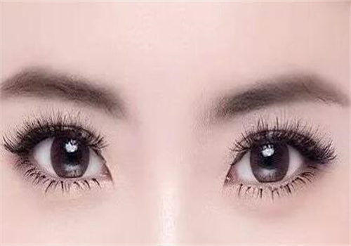 武漢王海平雙眼皮真的做得好嗎？KISS 仿生術(shù)式，微創(chuàng)自然恢復(fù)快超驚艷！