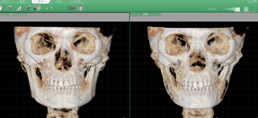 韓國345整形醫(yī)院輪廓