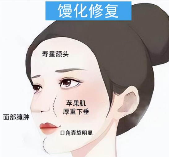 脂肪填充饅化問題解析