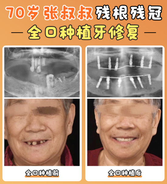 北京冠美口腔醫(yī)院到底靠不靠譜——服務質(zhì)量超貼心