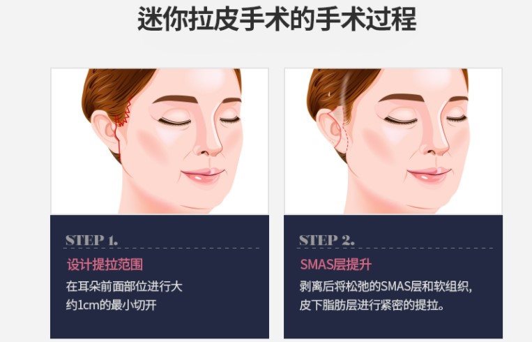 六、為什么選擇盧丙侖醫(yī)生進行整形縫合？