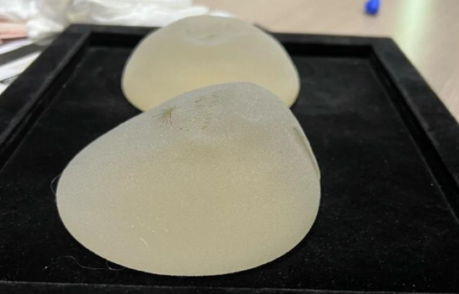 二、6位隆胸好醫(yī)生專門解析www.66ub.cn