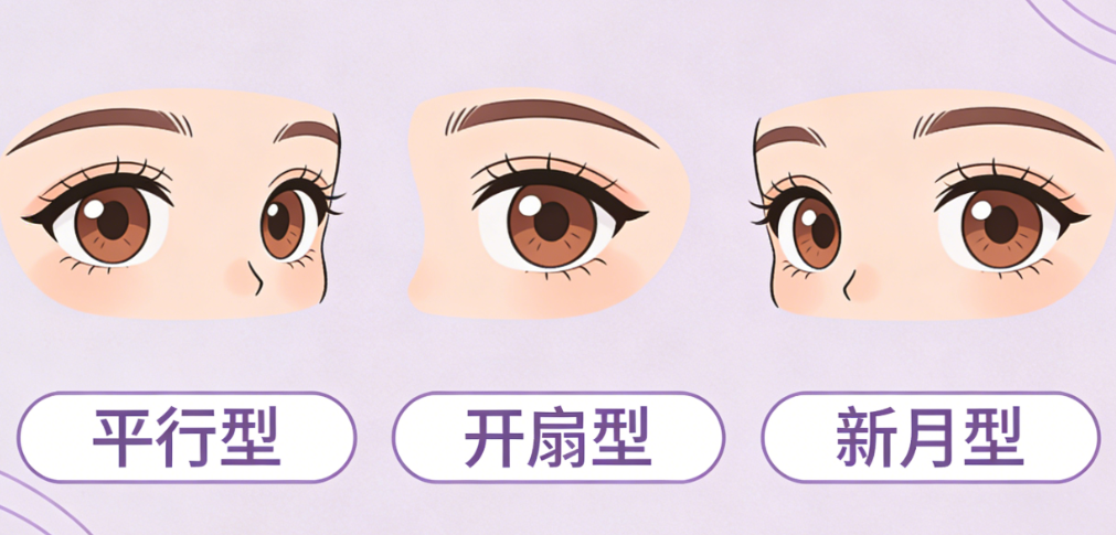 劉平醫(yī)生雙眼皮修復(fù)技術(shù)特點(diǎn)