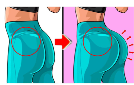 一、玻尿酸豐臀一年后的真實實例分享