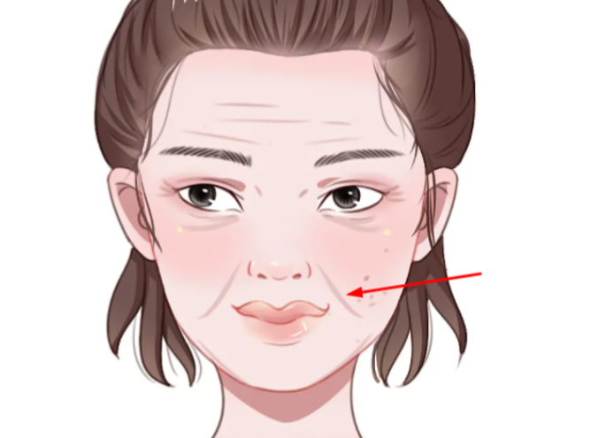 三、熱門機構(gòu)的法令紋三件套特色及維持時間