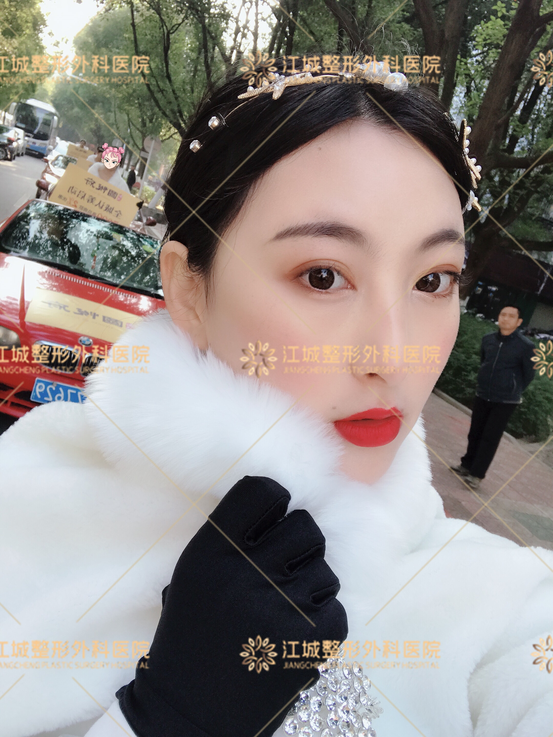 應(yīng)急總醫(yī)院梁醫(yī)生眼周復(fù)位術(shù)技術(shù)特點(diǎn)