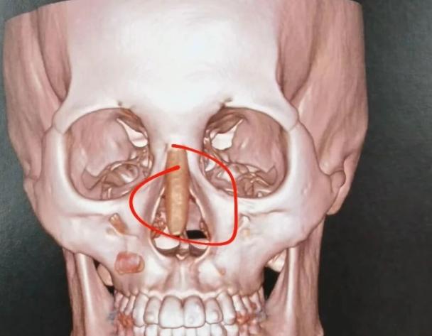 一、吳玉家是戴傳昌的徒弟嗎？?jī)晌会t(yī)生獨(dú)立深耕，無任何師徒傳承關(guān)聯(lián)
