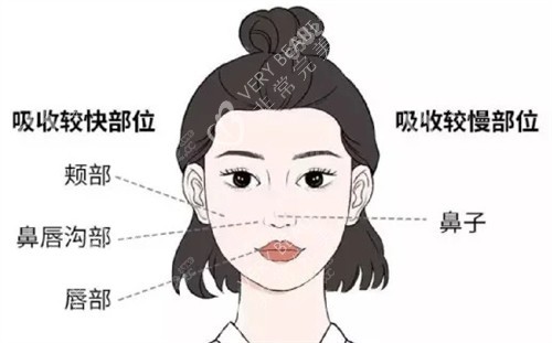 饅化臉修復(fù)方法