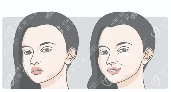 饅化臉對(duì)比照片
