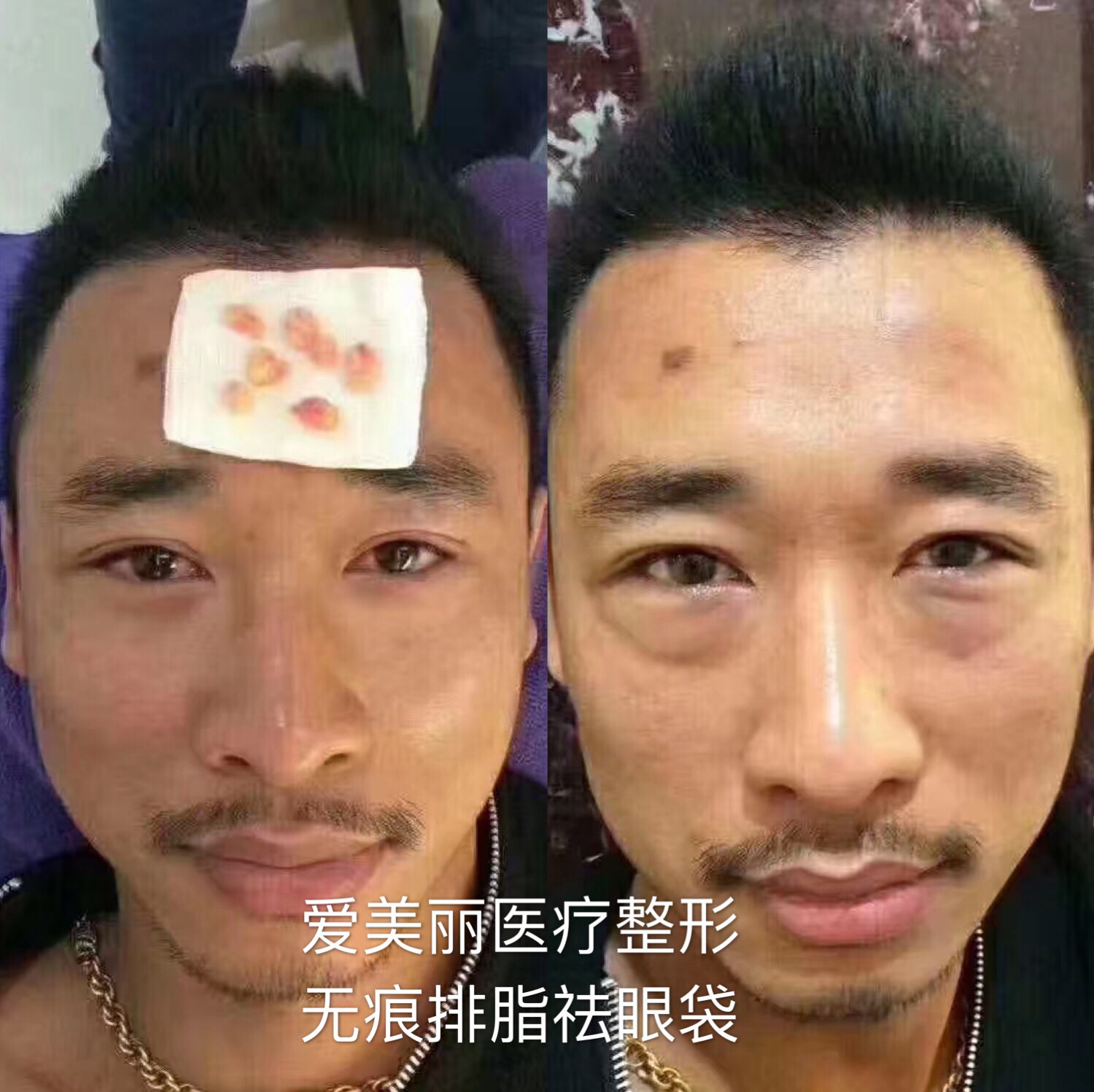 賀潔醫(yī)生技術(shù)實(shí)力：精細(xì)操作，成效顯著