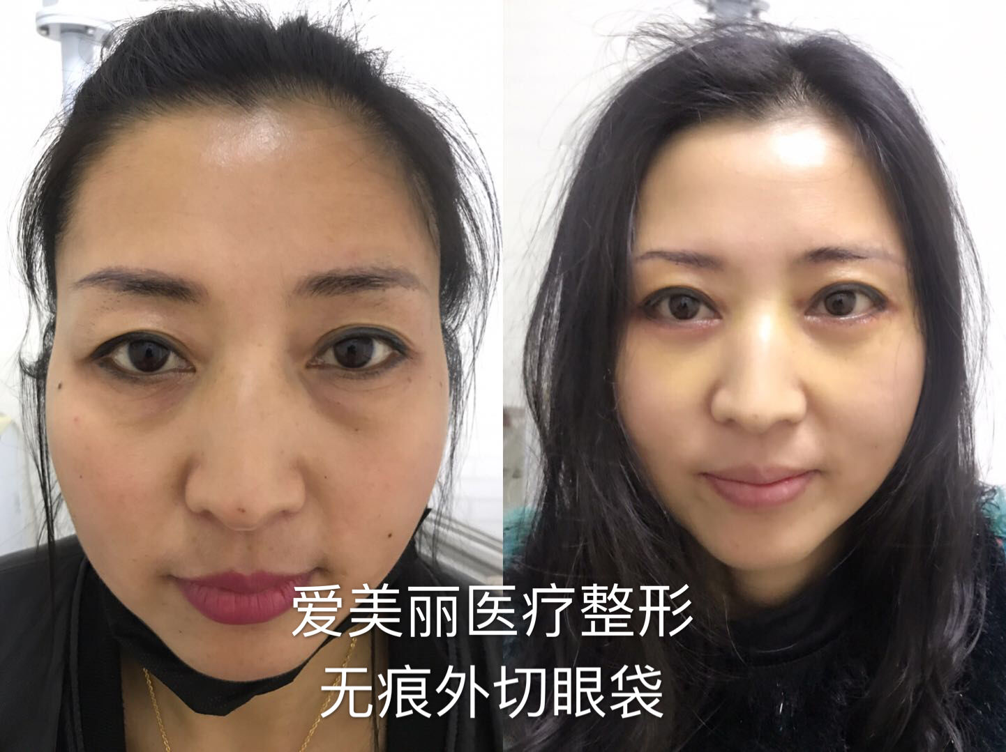 賀潔醫(yī)生：不錯技術(shù)顯實力