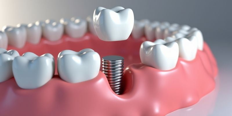 宜賓為笑口腔醫(yī)院種植牙體選擇豐富嗎？
