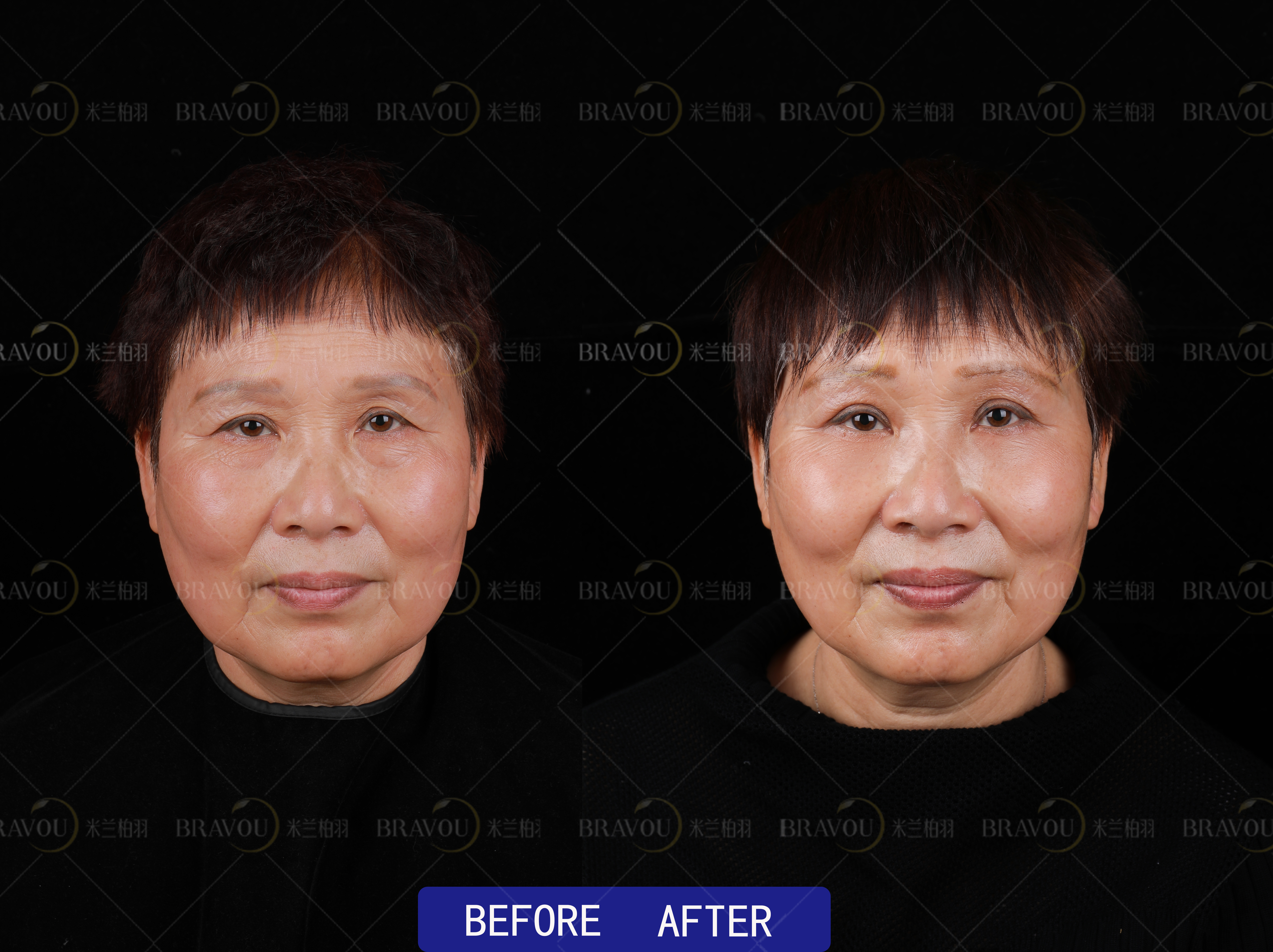 賀潔醫(yī)生:收費透明無套路