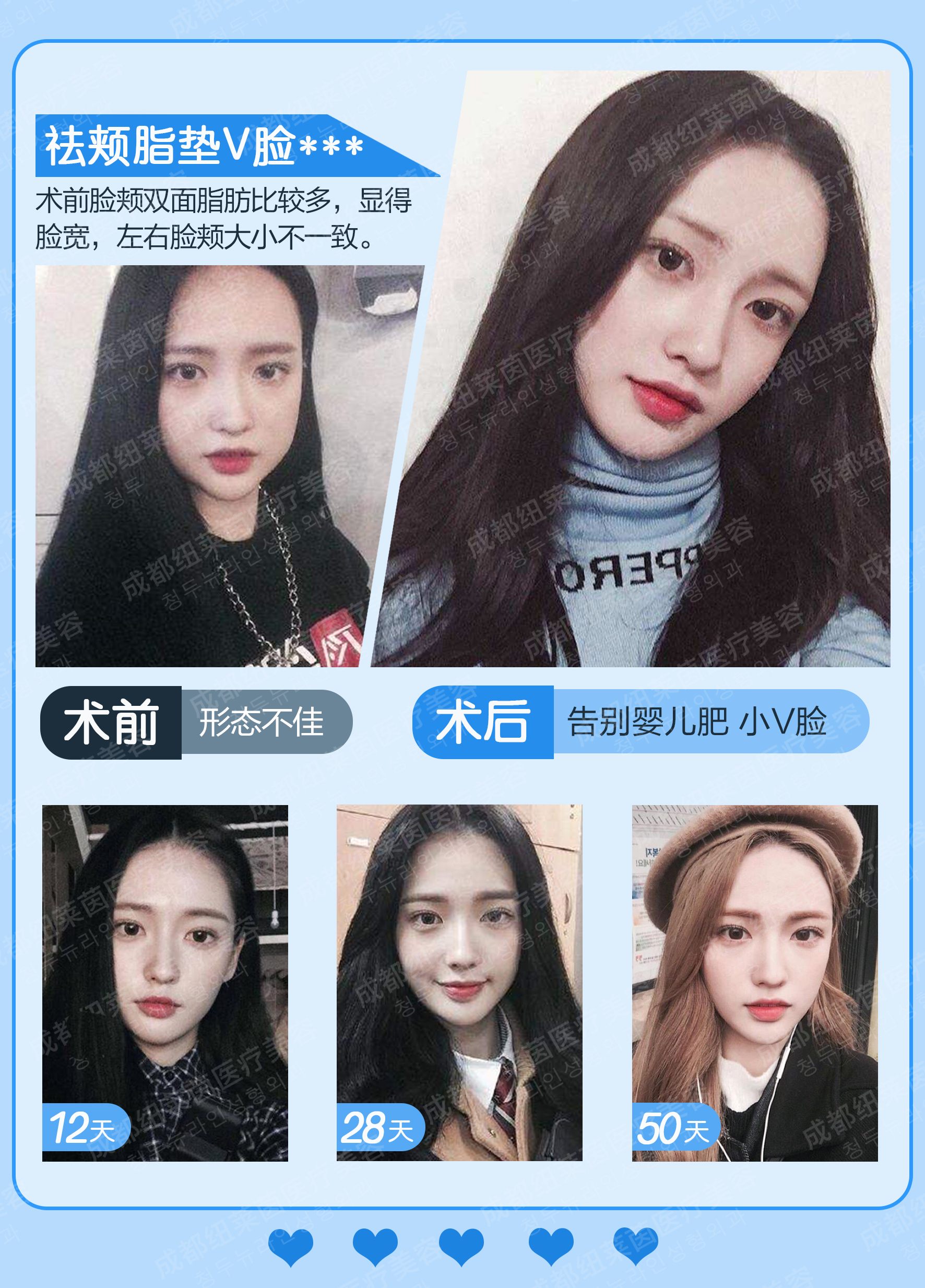 想了解青島博士醫(yī)療美容醫(yī)院醫(yī)生情況？郭鵬、李云峰等醫(yī)生各有專長超靠譜！ 