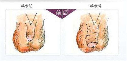 選男科醫(yī)院小技巧