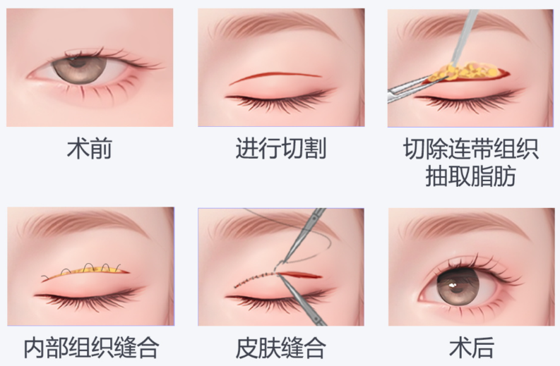 曾翾在上海眼修復(fù)醫(yī)生中很有名