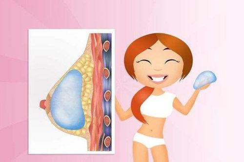 全國(guó)有名的十位隆胸醫(yī)生名單