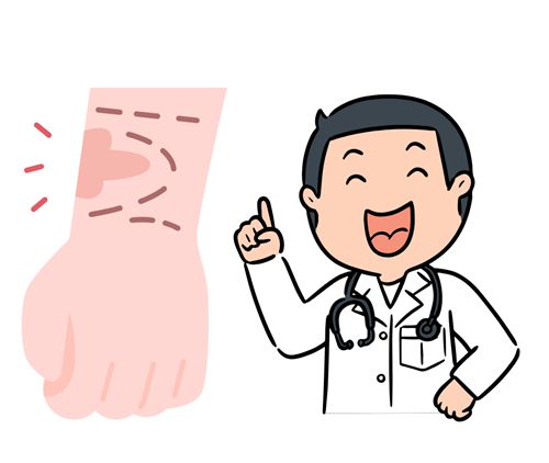 三、山西疤痕切縫手術(shù)就診實(shí)用指南