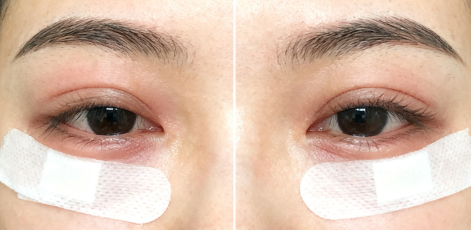 5. 福州臺江海峽美容醫(yī)院——程明醫(yī)生