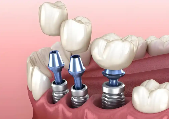 三、就醫(yī)選擇路徑