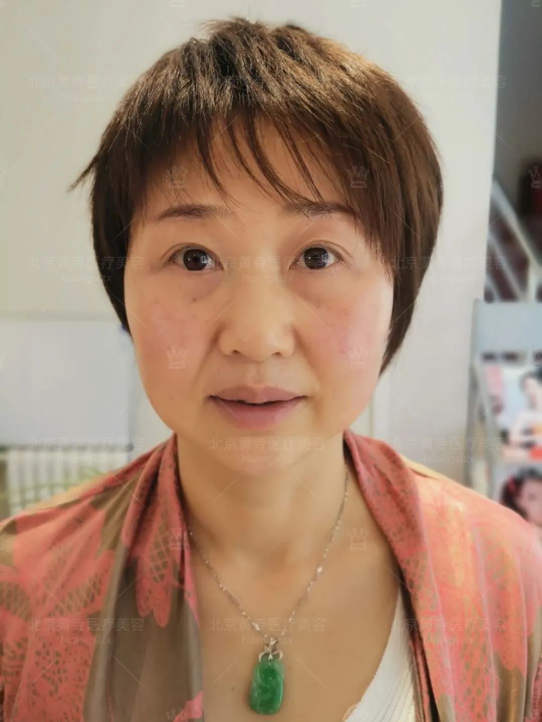 四、成效持久性令人放心