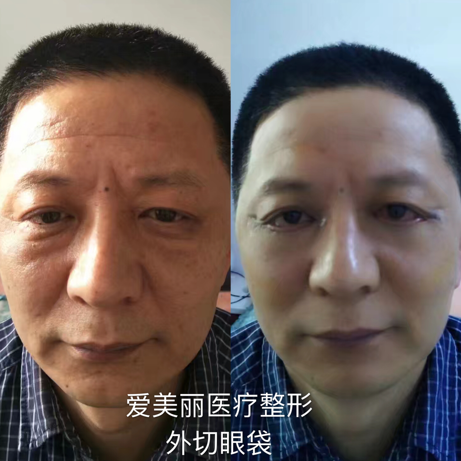 二、正規(guī)性保護可靠性