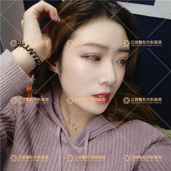 青島博士醫(yī)療美容醫(yī)院其他方面也特別棒，值得選擇！