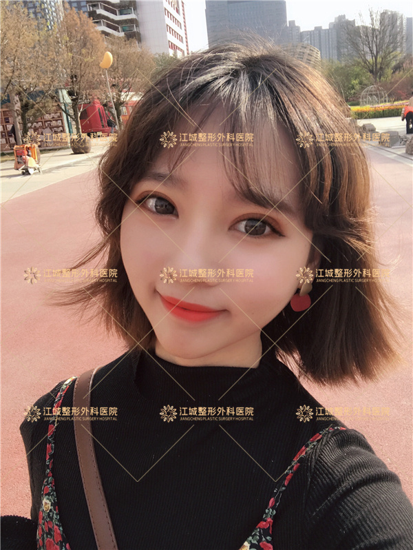 青島博士醫(yī)療美容醫(yī)院眼部手術(shù)超厲害，成效看得見！