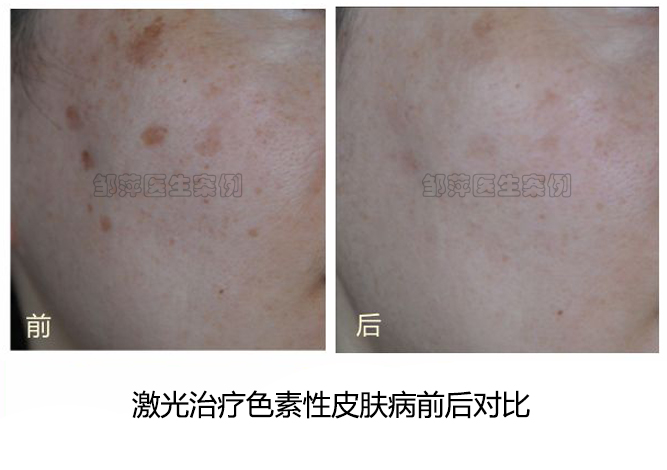 二、大連祛斑出名的三家醫(yī)院詳細(xì)介紹