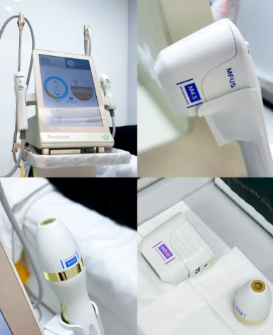 半島超聲炮和鉆石超聲炮的功能區(qū)別