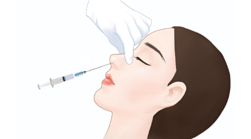 優(yōu)法蘭CC針介紹