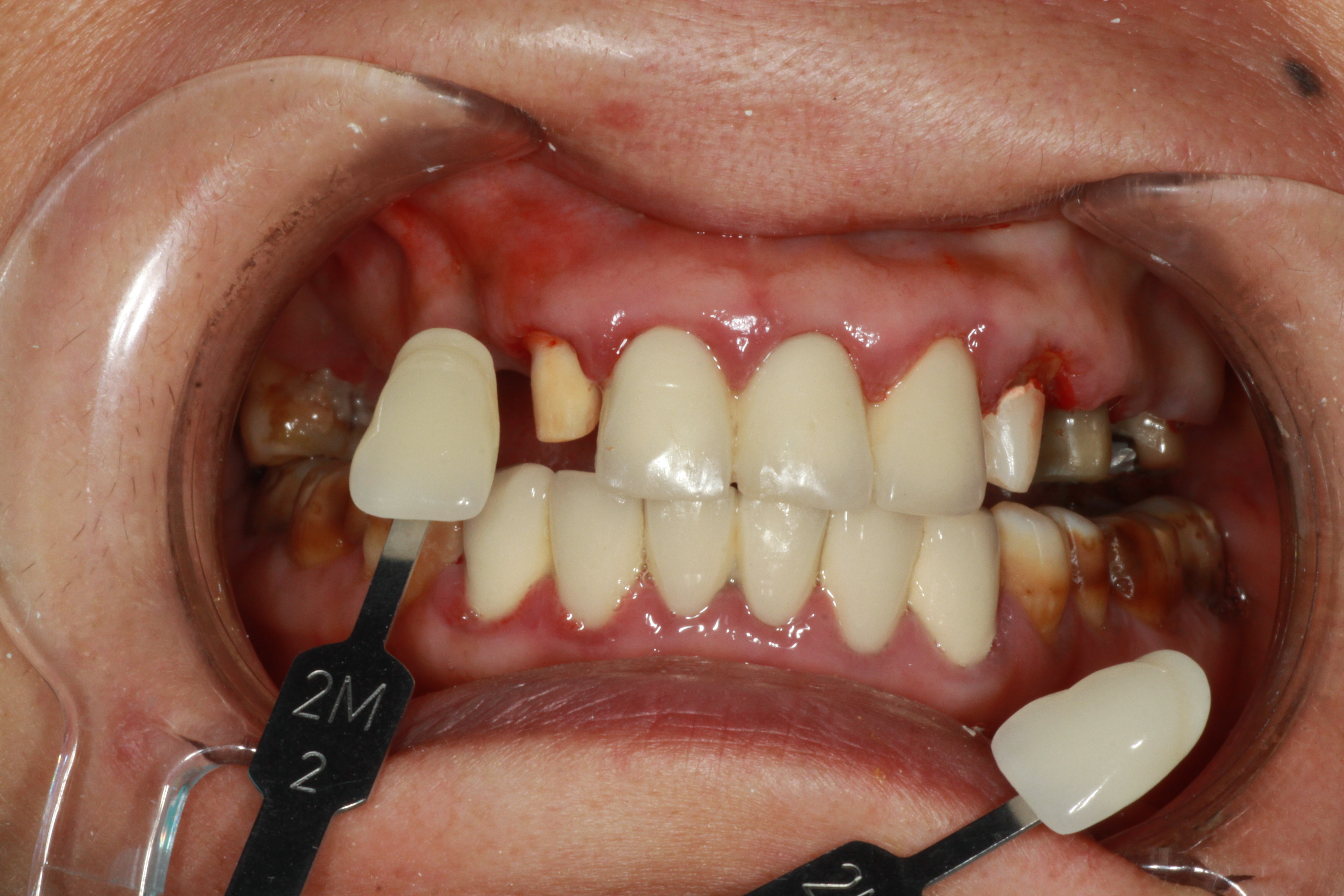 廣州優(yōu)潔美口腔——專精的醫(yī)生團(tuán)隊(duì)