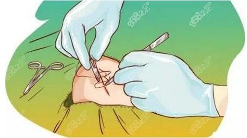 李方奇醫(yī)生患者評(píng)價(jià)好